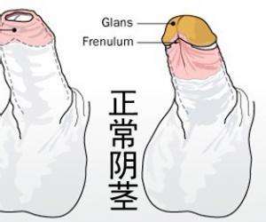 包茎3.jpg