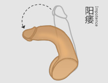 兰州治疗阳痿注意事项有哪些